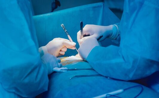 perform penis enlargement surgery